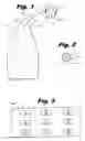 Fig. 02 - Skin abrasion system and method