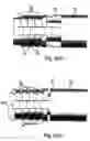 Fig. 06 - Device for enabling the treatment of hemorrhoids