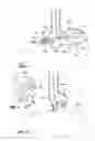 Fig. 02 - Endoscopic gastric constriction device