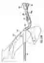 Fig. 32 - Articulating suturing device and method