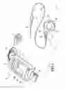 Fig. 02 - Telemetrically controlled band for regulating functioning of a body organ or duct, and methods of making, implantation and use