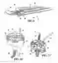 Fig. 05 - Telemetrically controlled band for regulating functioning of a body organ or duct, and methods of making, implantation and use
