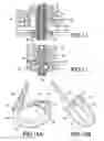 Fig. 06 - Telemetrically controlled band for regulating functioning of a body organ or duct, and methods of making, implantation and use