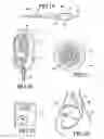 Fig. 07 - Telemetrically controlled band for regulating functioning of a body organ or duct, and methods of making, implantation and use