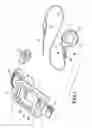 Fig. 02 - Telemetrically controlled band for regulating functioning of a body organ or duct, and methods of making, implantation and use