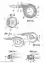 Fig. 03 - Telemetrically controlled band for regulating functioning of a body organ or duct, and methods of making, implantation and use