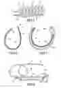 Fig. 04 - Telemetrically controlled band for regulating functioning of a body organ or duct, and methods of making, implantation and use