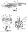 Fig. 05 - Telemetrically controlled band for regulating functioning of a body organ or duct, and methods of making, implantation and use