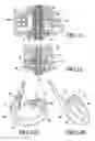 Fig. 06 - Telemetrically controlled band for regulating functioning of a body organ or duct, and methods of making, implantation and use