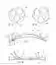 Fig. 10 - Distal wire stop