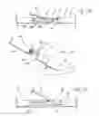 Fig. 14 - Distal wire stop