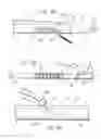 Fig. 22 - Distal wire stop