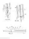 Fig. 28 - Distal wire stop