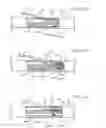 Fig. 31 - Distal wire stop