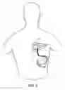Fig. 07 - Apparatus for detecting and treating ventricular arrhythmia