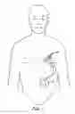Fig. 08 - Apparatus for detecting and treating ventricular arrhythmia