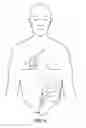 Fig. 09 - Apparatus for detecting and treating ventricular arrhythmia