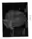 Fig. 06 - Method and system of treatment of heart failure using 4D imaging