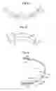 Fig. 07 - Current waveforms for anti-bradycardia pacing for a subcutaneous implantable cardioverter-defibrillator