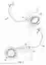 Fig. 03 - Method and system for providing pulsed electrical stimulation to sacral plexus of a patient to provide therapy for urinary incontinence and urological disorders