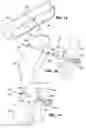 Fig. 07 - Gastrointestinal anchor with optimal surface area