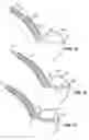 Fig. 08 - Gastrointestinal anchor with optimal surface area