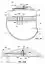 Fig. 10 - Gastrointestinal anchor with optimal surface area
