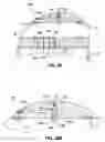 Fig. 11 - Gastrointestinal anchor with optimal surface area