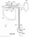 Fig. 20 - Gastrointestinal anchor with optimal surface area