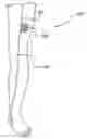 Fig. 01 - Methods and systems for stimulating a peripheral nerve to treat chronic pain