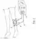 Fig. 02 - Sap adjuster