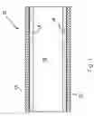 Fig. 02 - Systems and methods for overcoming or preventing vascular flow restrictions