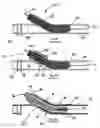 Fig. 22 - Systems and methods for overcoming or preventing vascular flow restrictions