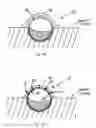 Fig. 32 - Systems and methods for overcoming or preventing vascular flow restrictions