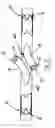 Fig. 34 - Systems and methods for overcoming or preventing vascular flow restrictions