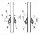 Fig. 37 - Systems and methods for overcoming or preventing vascular flow restrictions