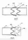 Fig. 40 - Systems and methods for overcoming or preventing vascular flow restrictions