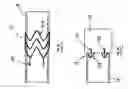 Fig. 41 - Systems and methods for overcoming or preventing vascular flow restrictions
