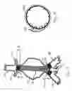 Fig. 03 - Method and system for fixation of endoluminal devices
