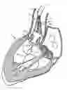 Fig. 01 - Methods and apparatus for endovascularly replacing a heart valve