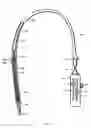 Fig. 02 - Methods and apparatus for endovascularly replacing a heart valve