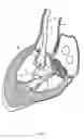 Fig. 07 - Methods and apparatus for endovascularly replacing a heart valve