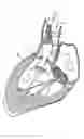 Fig. 08 - Methods and apparatus for endovascularly replacing a heart valve