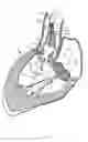Fig. 09 - Methods and apparatus for endovascularly replacing a heart valve