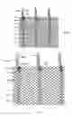 Fig. 11 - Methods and apparatus for endovascularly replacing a heart valve