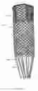 Fig. 15 - Methods and apparatus for endovascularly replacing a heart valve