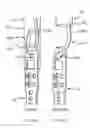 Fig. 26 - Methods and apparatus for endovascularly replacing a heart valve