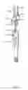 Fig. 27 - Methods and apparatus for endovascularly replacing a heart valve