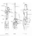 Fig. 30 - Methods and apparatus for endovascularly replacing a heart valve