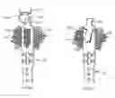 Fig. 31 - Methods and apparatus for endovascularly replacing a heart valve